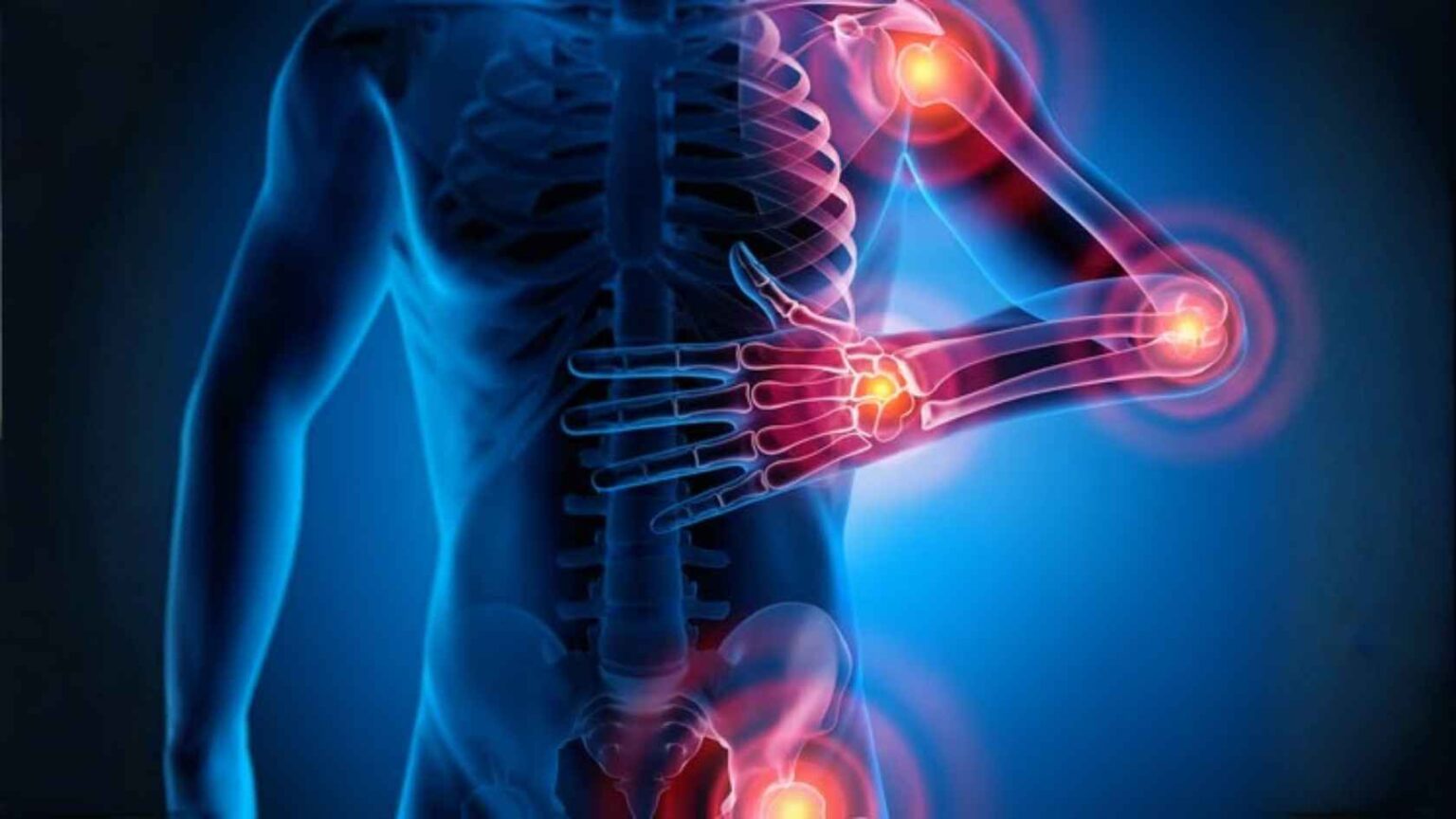 What Is Rheumatism? Types, Symptoms, Treatment Approach