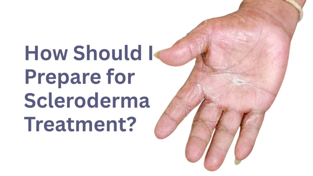Hand with skin dryness and tightening illustrating preparation for scleroderma treatment