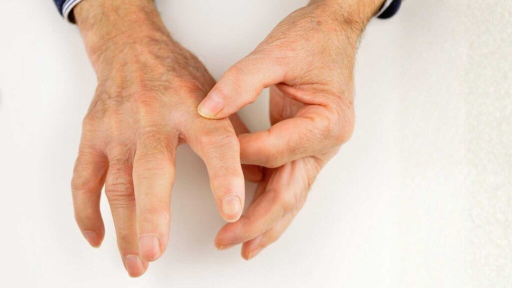 Scleroderma Diagnosis and Evaluation