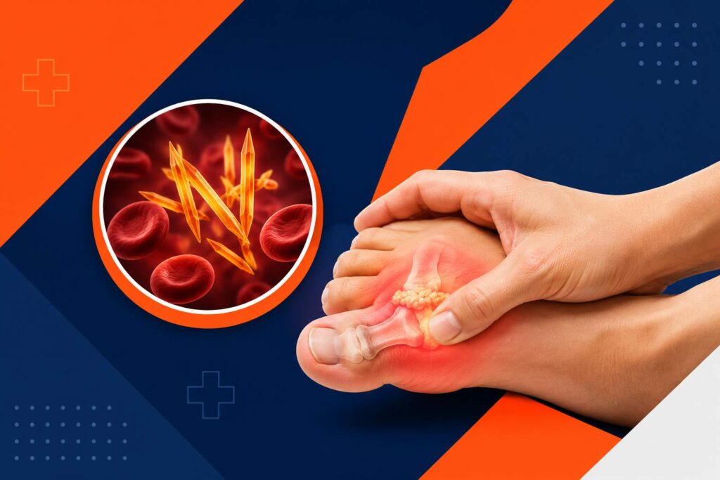 Why Uric Acid Levels Increase in Adults image showing painful gout inflammation and uric acid crystal deposits in the big toe joint