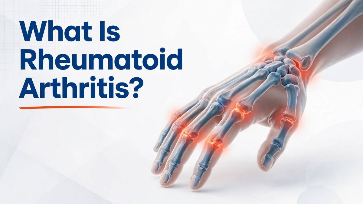 What Is Rheumatoid Arthritis?